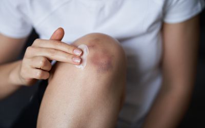 Post-Healing Pain in Hyderabad 
