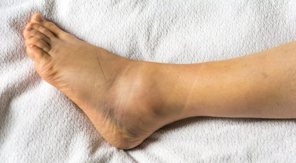 pain management specialist for an ankle injury in Hyderabad 