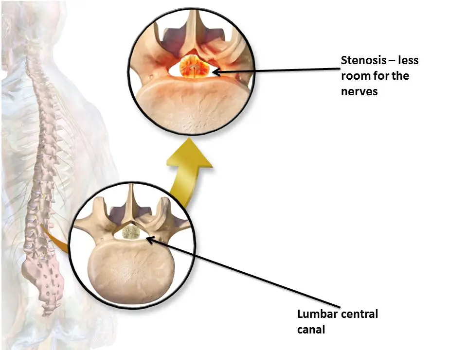 Interventional Pain Management in Hyderabad 