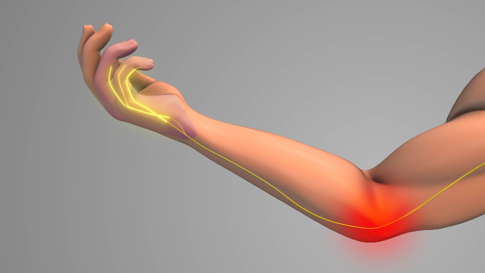 Ultrasound-Guided Nerve Block Check in Hyderabad 