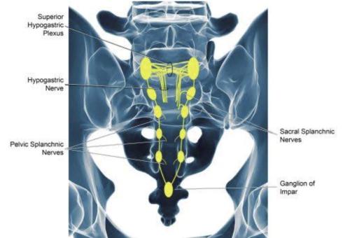 Superior-Hypogastric-Plexus-Block1